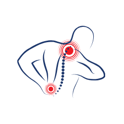 physiotherapy